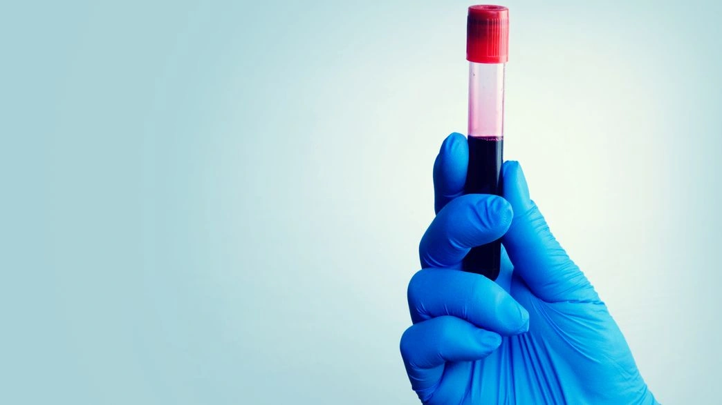 اختبار الدم
