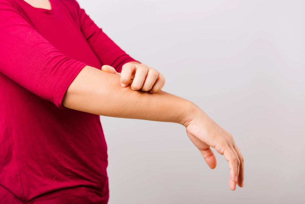 أعراض الحساسية من البطيخ