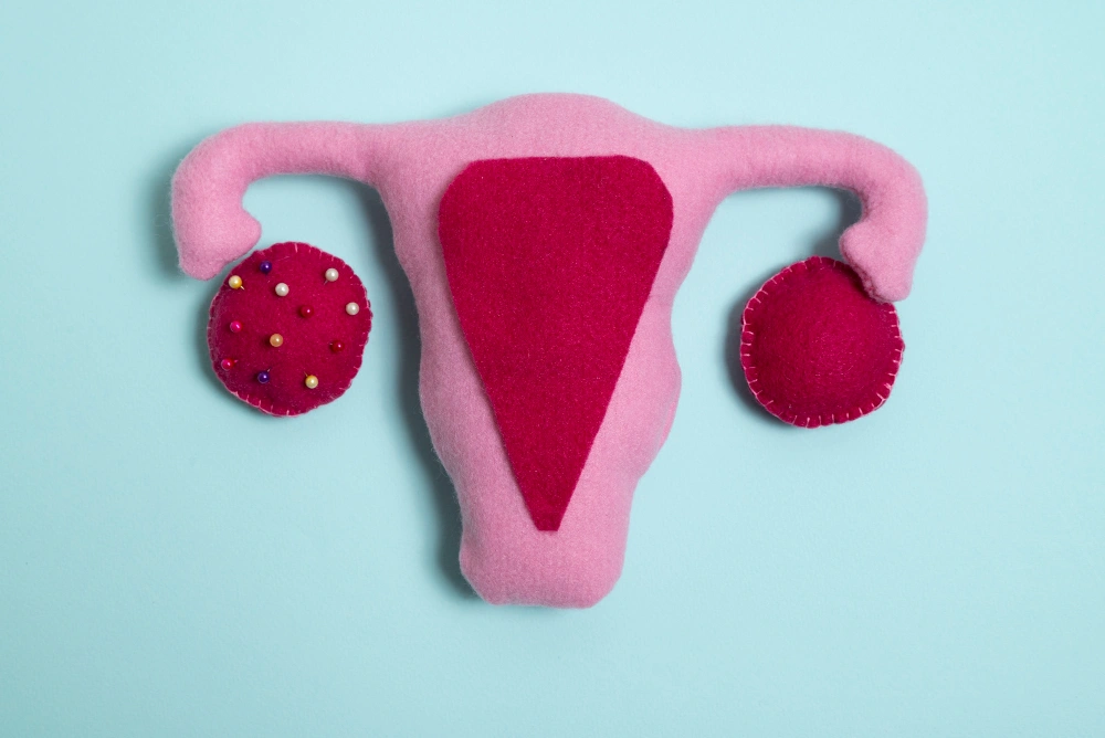 أسباب متلازمة تكيس المبايض وارتباطها بالسمنة والعقم