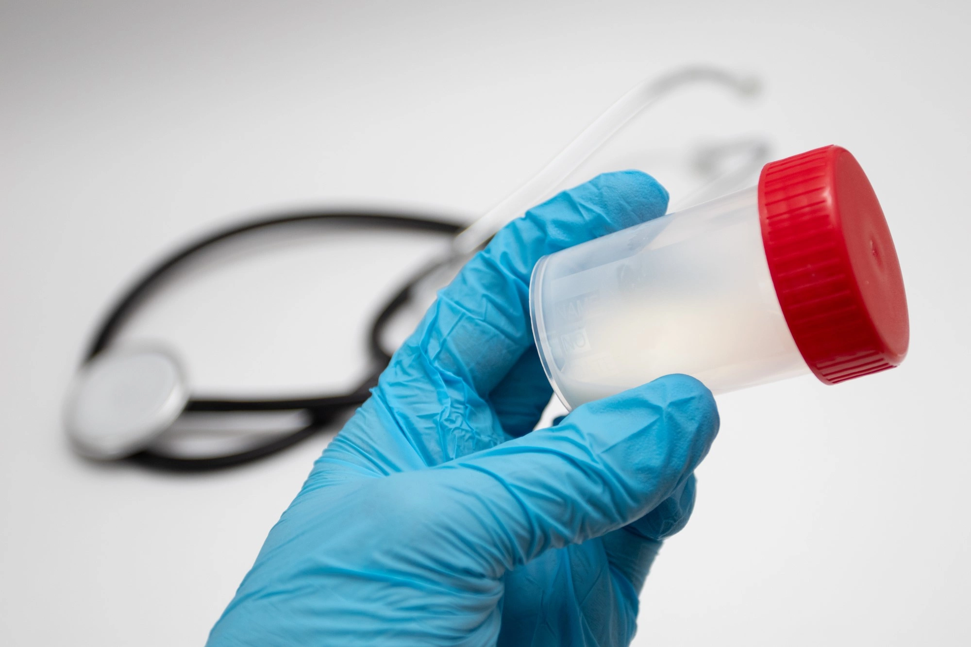 تحليل السائل المنوي