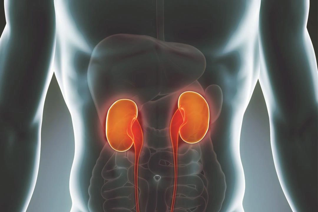 سرطان الكلى