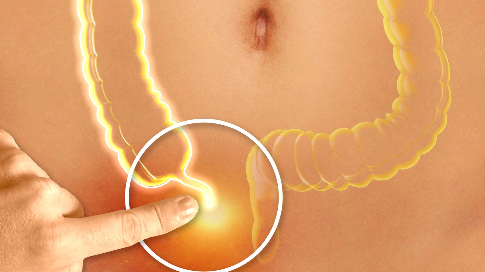 الزائدة الدودية أين تقع؟