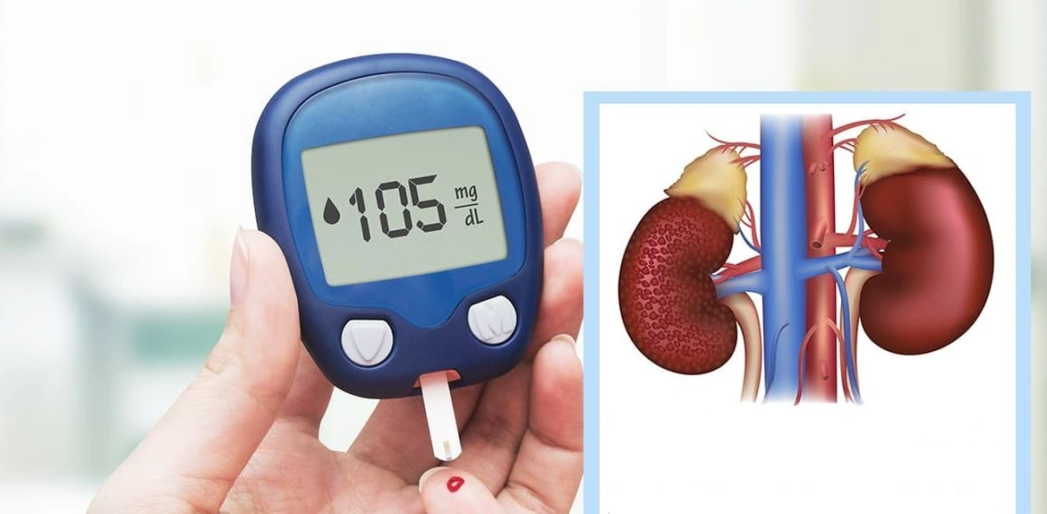 تأثير السكر على الكلى: كيف يحمي مريض السكري كليتيه من التلف؟