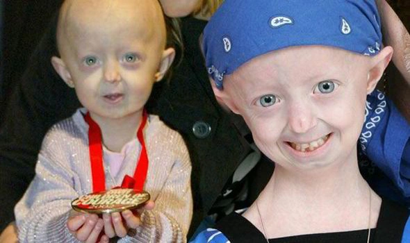 أعراض الشيخوخة المبكرة عند الأطفال