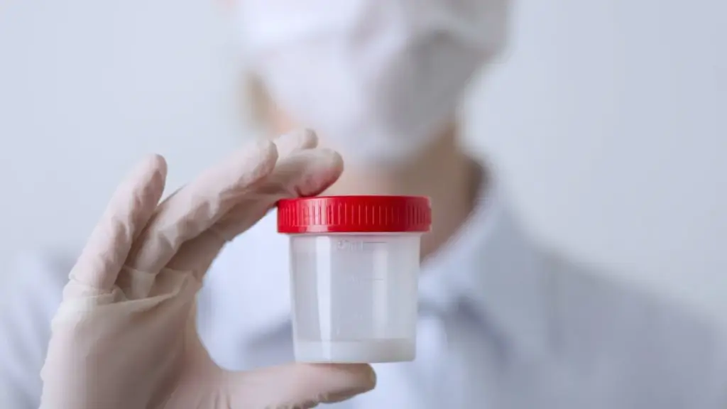 تحليل السائل المنوي: دليلك الشامل لفهم النتائج وتشخيص أسباب تأخر الإنجاب