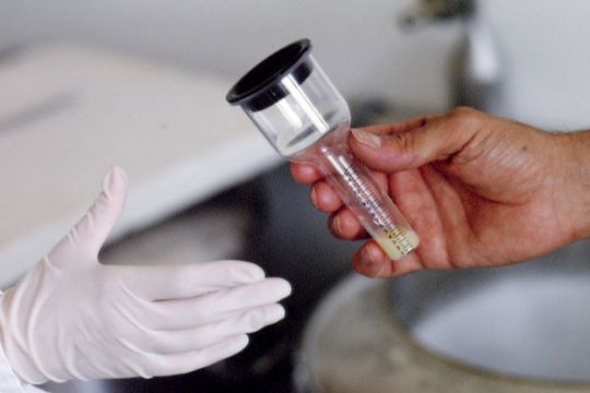 طريقة تحليل السائل المنوي للرجل