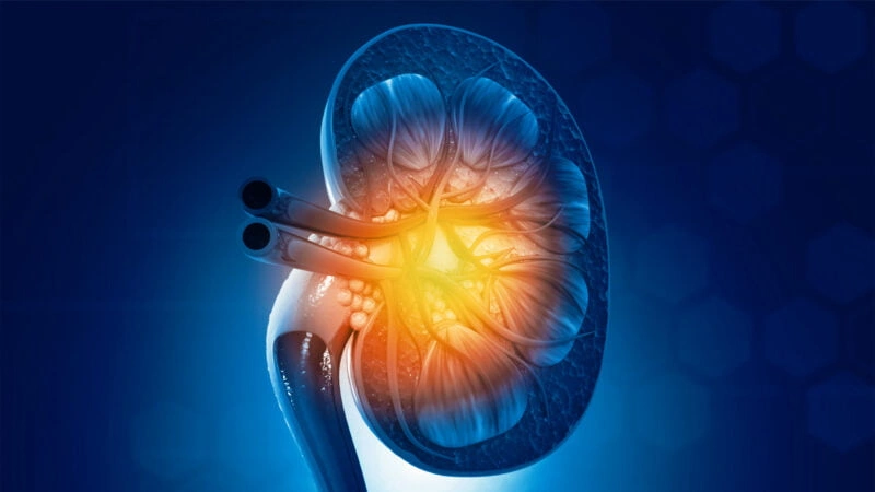 سرطان الكلى: كل ما يجب أن تعرفه من التشخيص إلى الشفاء