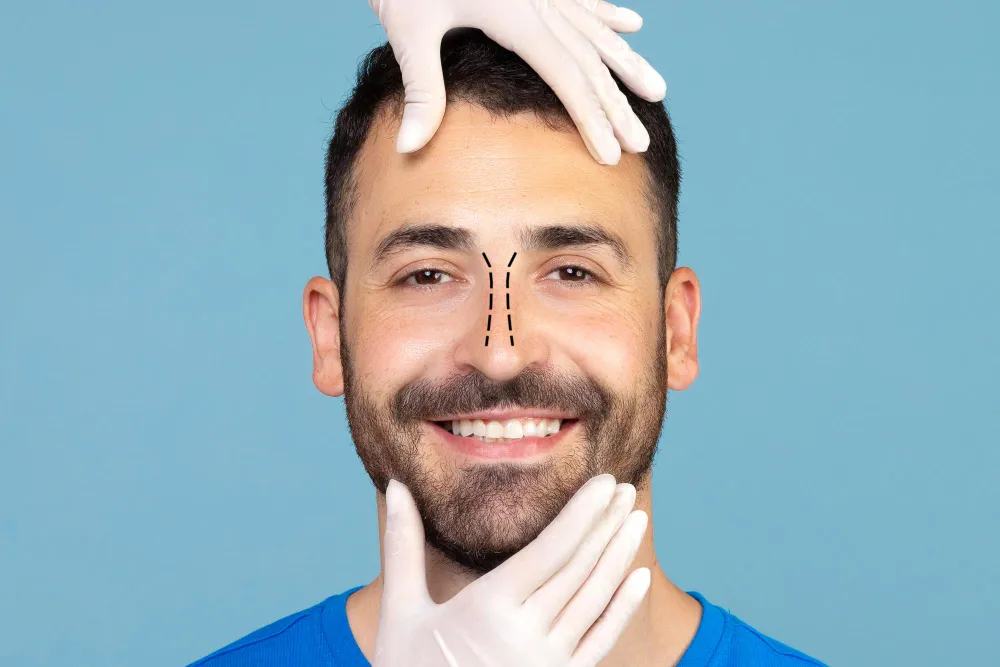 عملية تجميل الأنف