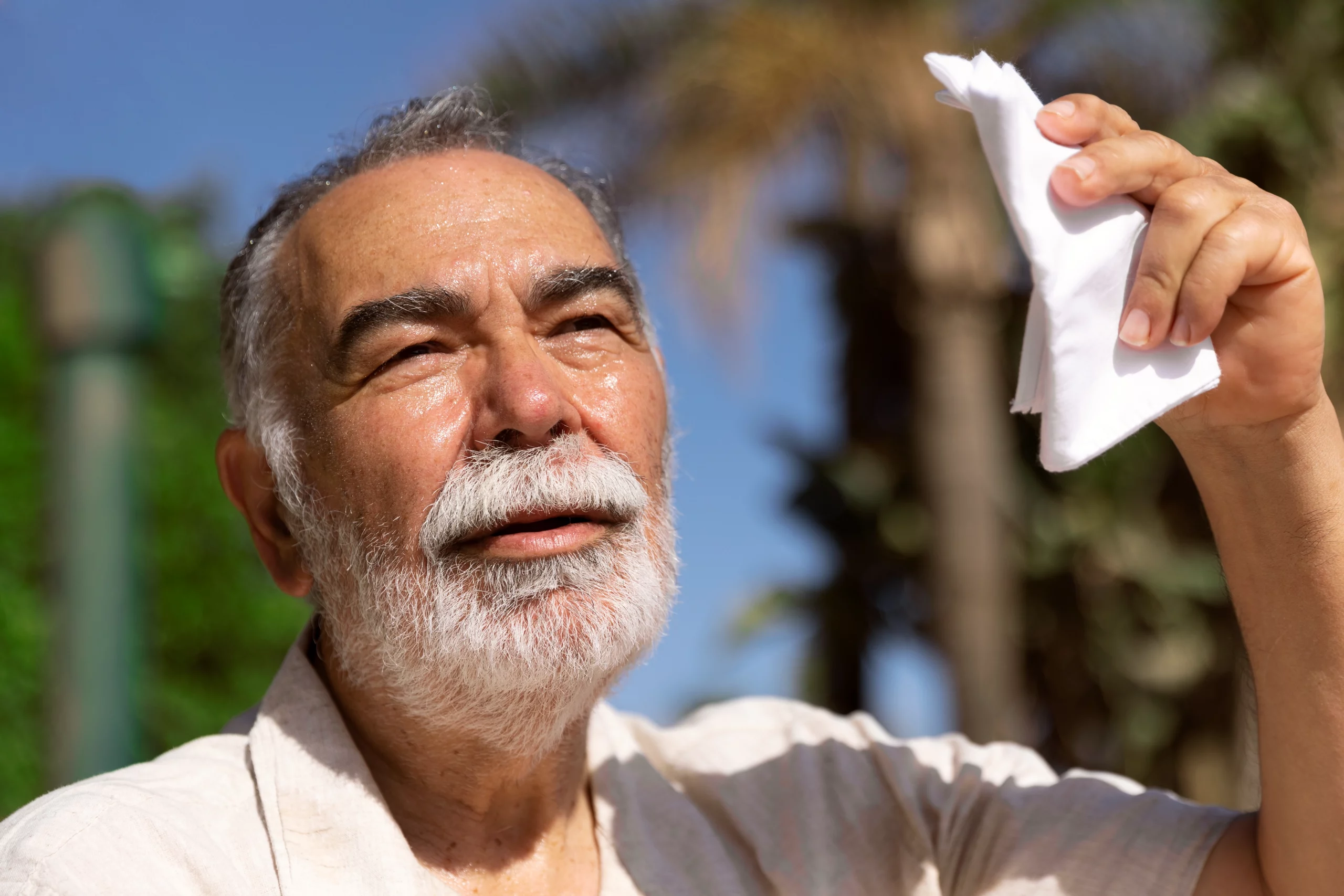 ضربة الشمس