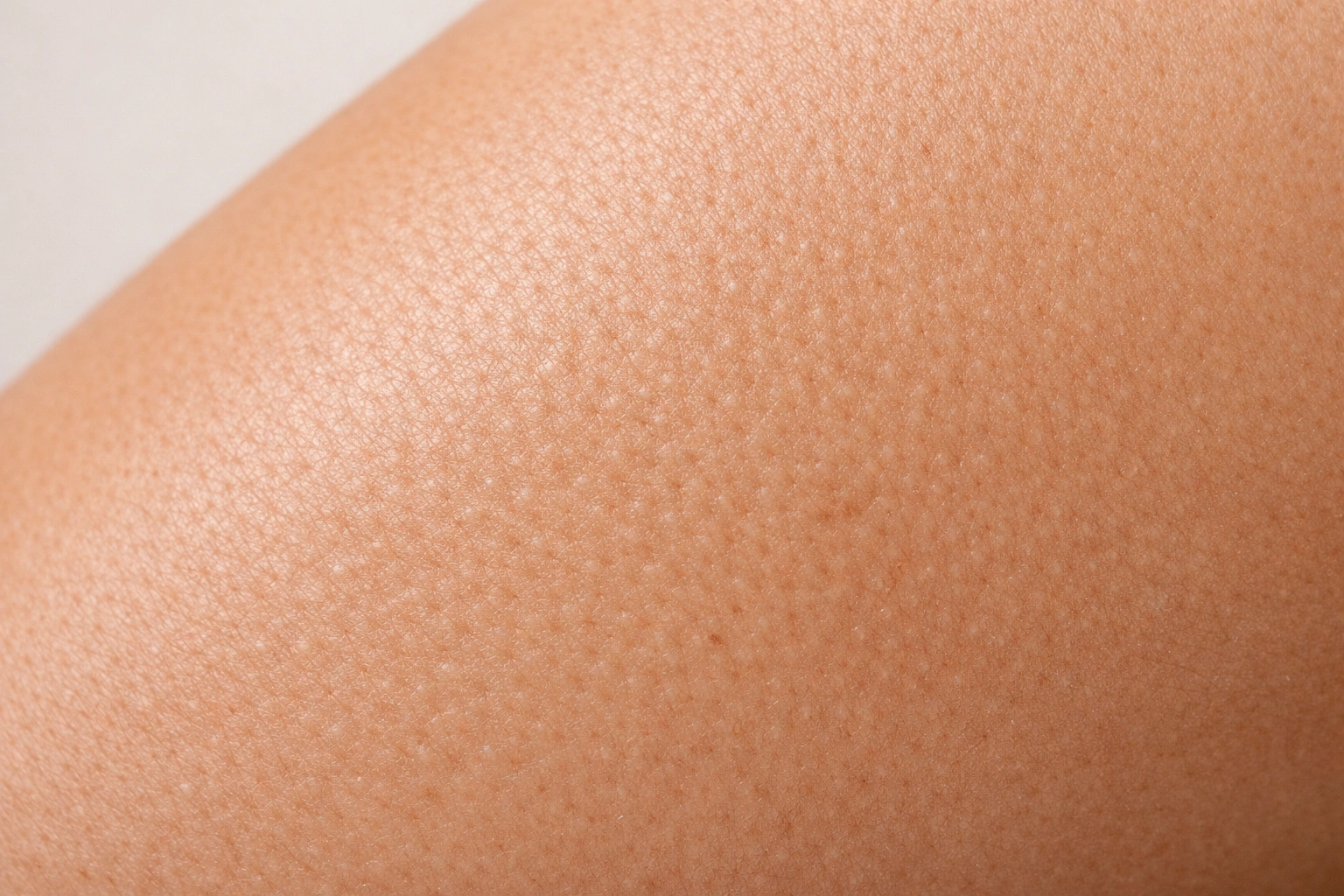 وداعًا لمشكلة السيلوليت..إليك أفضل الحلول الحديثة